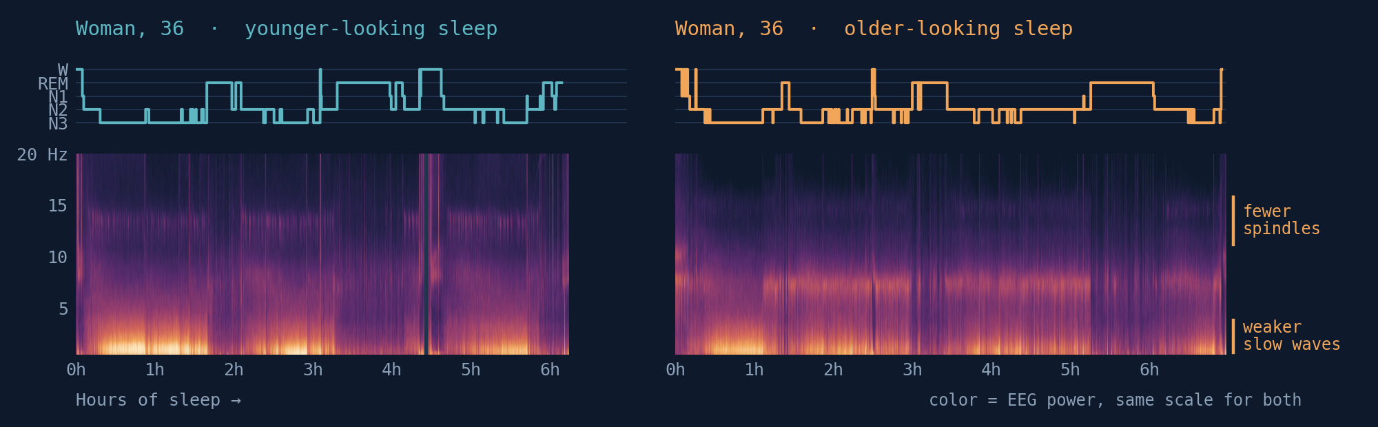 Two nights of sleep EEG from two 36-year-old women, each a hypnogram over a spectrogram on one shared time axis. The first night has younger-looking sleep: strong slow-wave power low in the spectrogram and a clear band of sleep spindles near 13 hertz. The second has older-looking sleep: visibly weaker slow waves and fewer spindles.